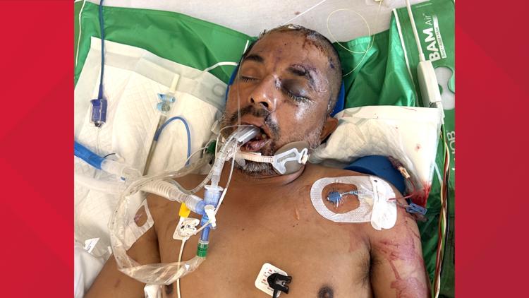 University Hospital asks for help identifying unconscious patient hit by truck Saturday evening — KENS 5 (San Antonio), Savage Health news